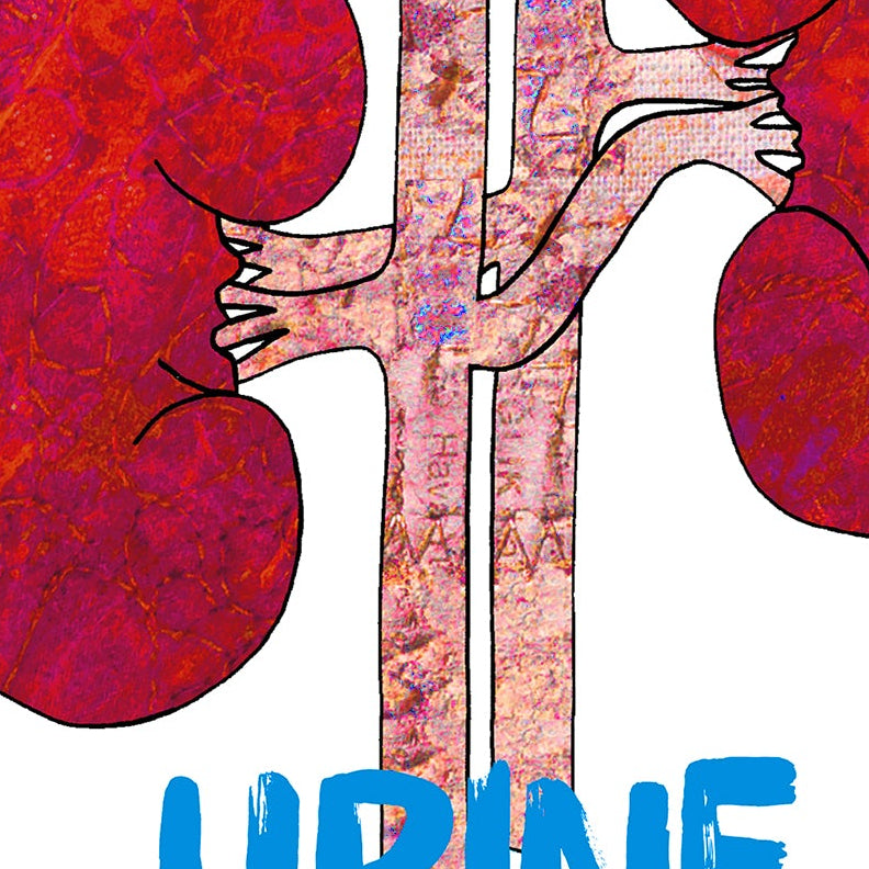 Kidney Surgery Get Well Card, Good Luck Renal Operation, A5 Personalised Card