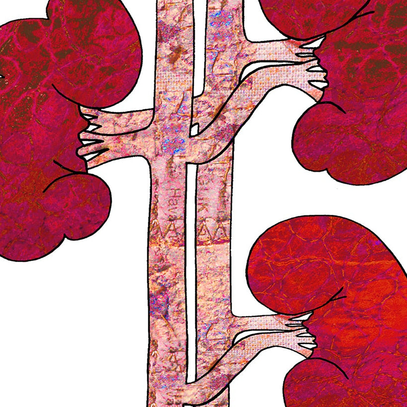 Kidney Transplant Get Well Card, Good Luck Renal Operation, A5 Personalised Card