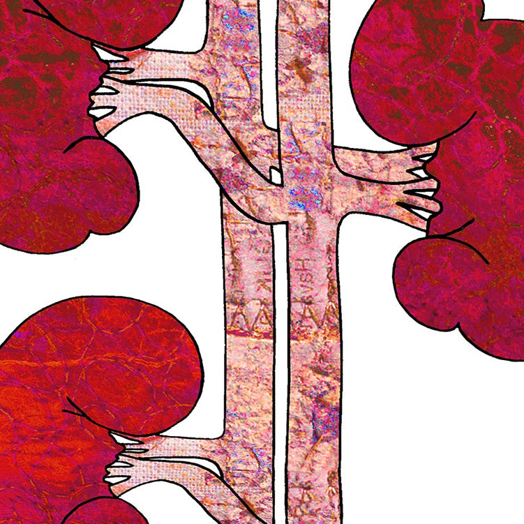 Kidney Transplant Get Well Card, Good Luck Renal Operation, A5 Personalised Card