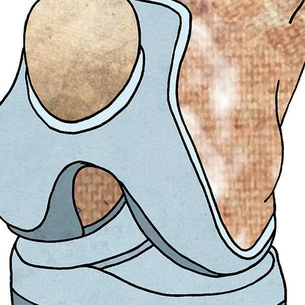 A5 Knee Replacement Surgery Get Well Personalised Card, Take it Nice and Kneesy